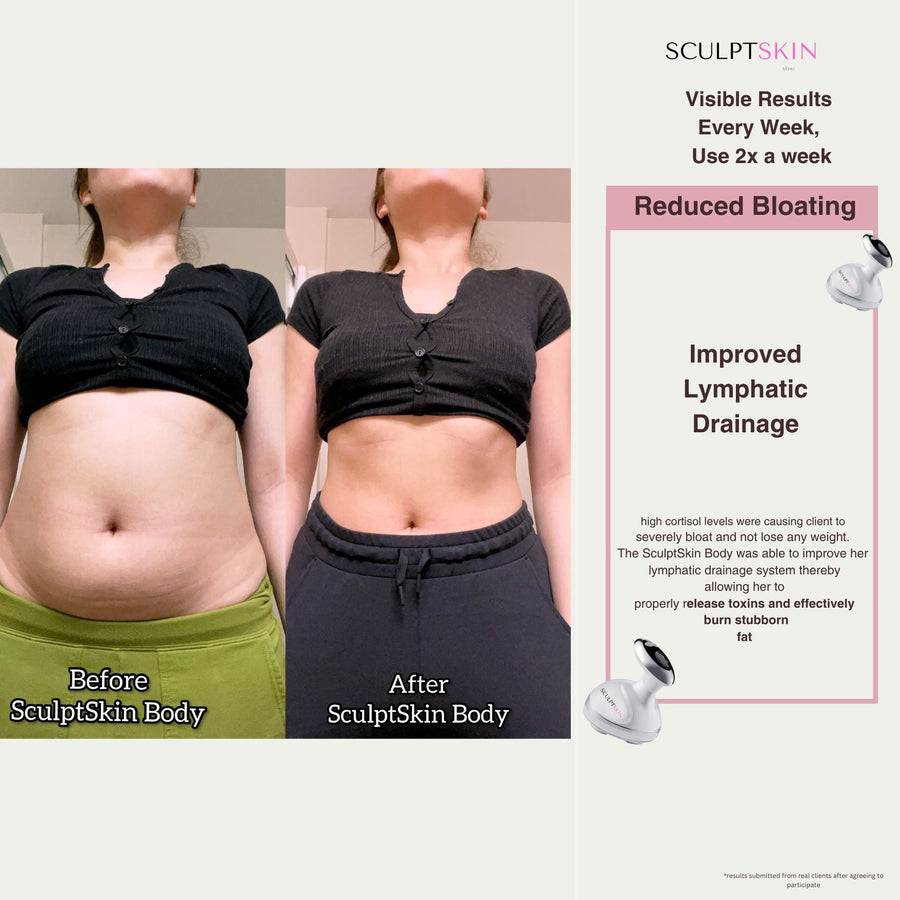 SculptSkin™ Body Sculpting - SculptSkin