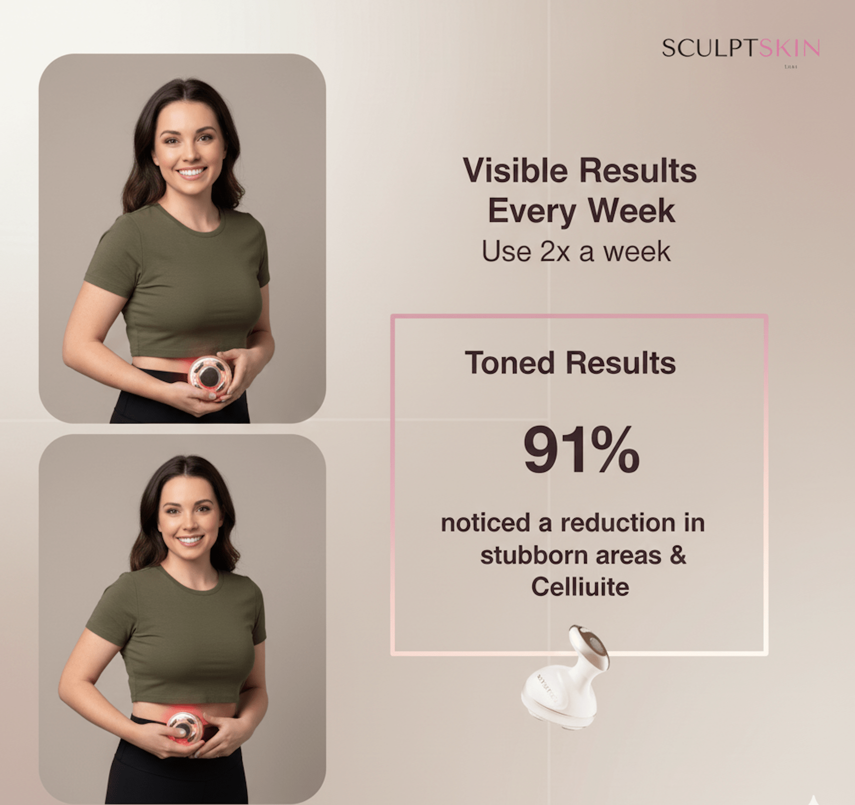 SculptSkin™ Body Sculpting - SculptSkin