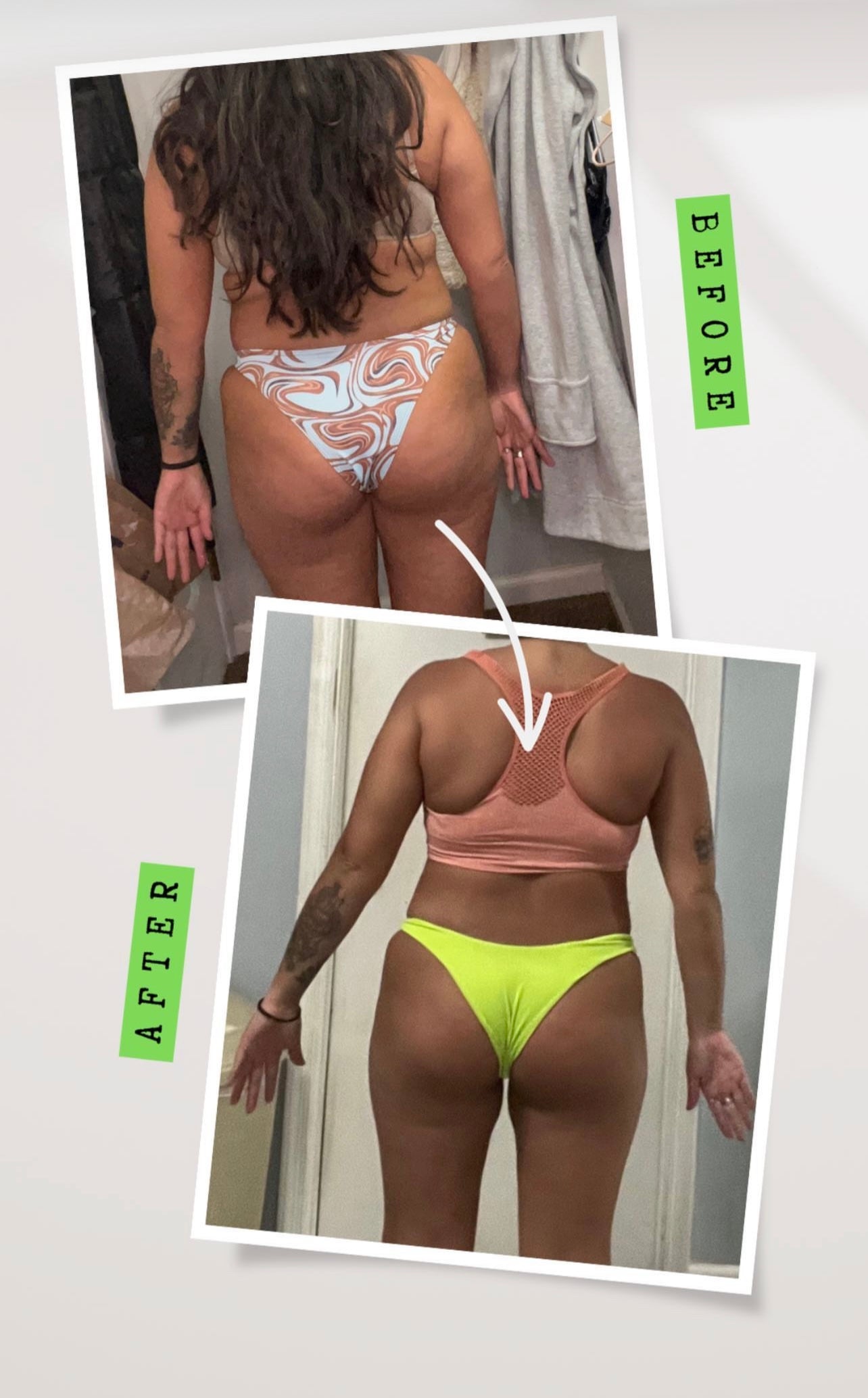 SculptSkin™ Mini 2.0 Body Sculpting - SculptSkin Achieve body contouring and shaping with Ultrasonic Cavitation, a non-surgical fat reduction treatment. Safe and effective for targeting stubborn areas like the waist, thighs, hips, back, and arms—an ideal alternative to liposuction