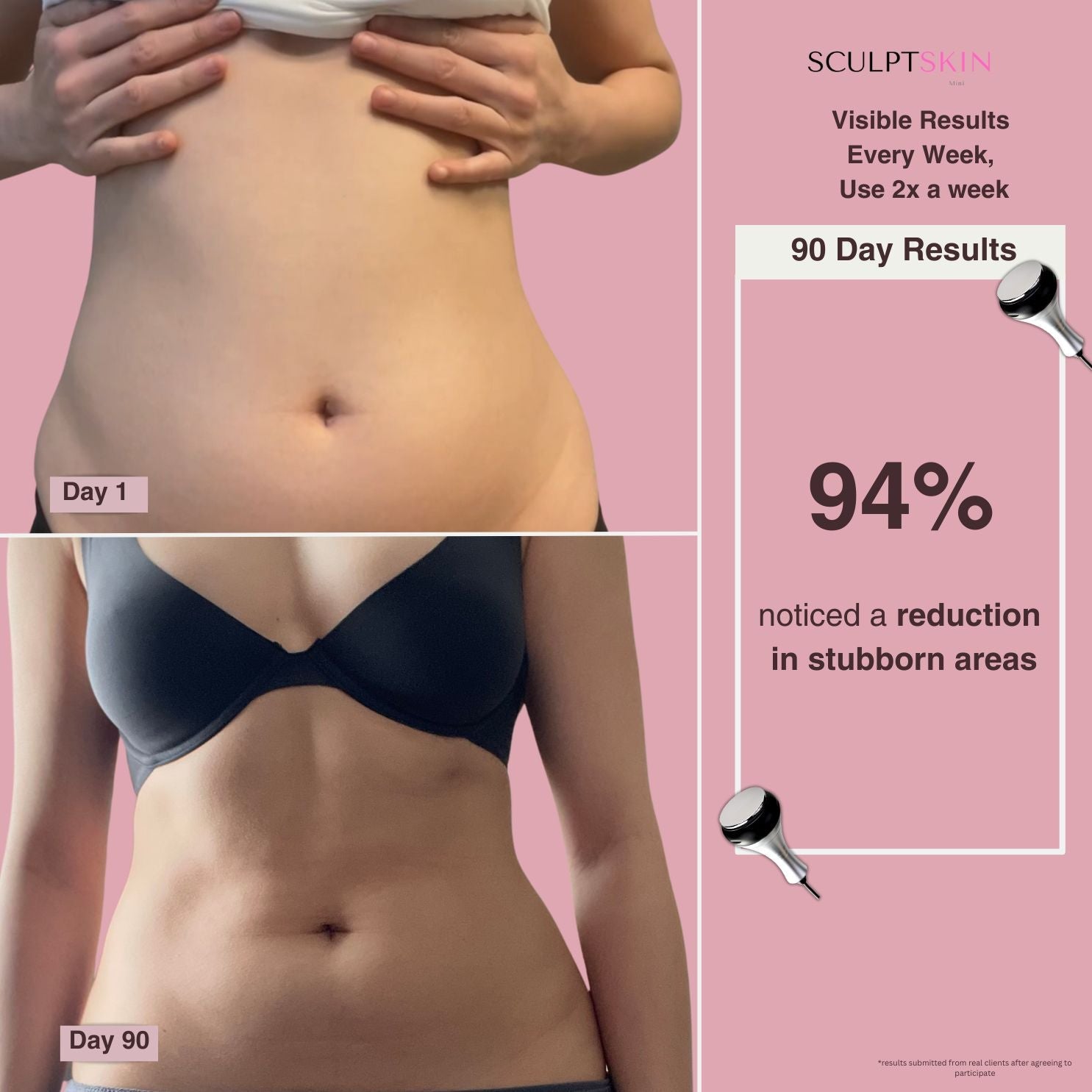 SculptSkin™ Mini 2.0 Body Sculpting - SculptSkin Achieve body contouring and shaping with Ultrasonic Cavitation, a non-surgical fat reduction treatment. Safe and effective for targeting stubborn areas like the waist, thighs, hips, back, and arms—an ideal alternative to liposuction.