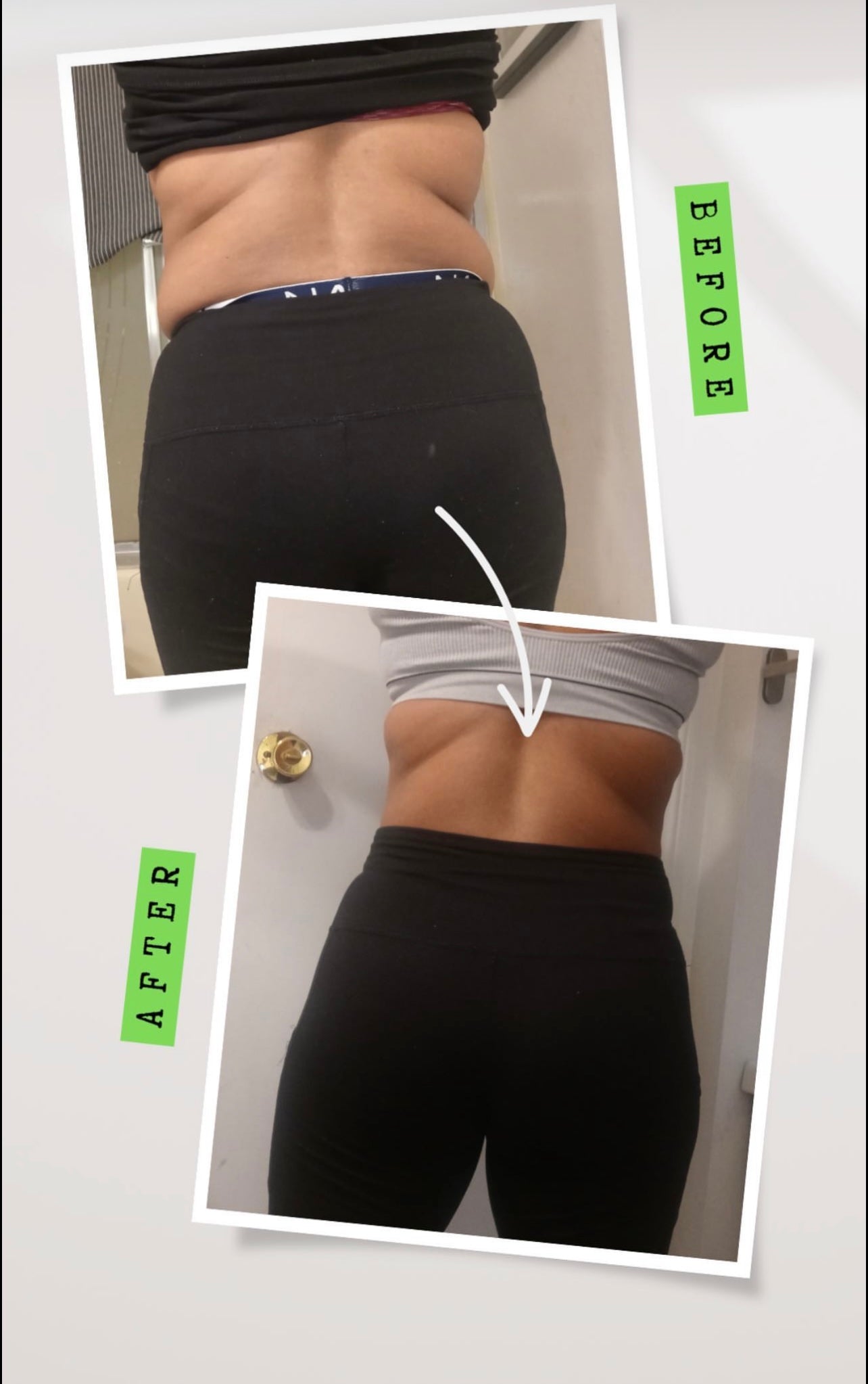 SculptSkin™ Mini 2.0 Body Sculpting - SculptSkin Experience non-surgical body contouring with Ultrasonic Cavitation. A safe, effective treatment for fat reduction in problem areas like the waist, back, and thighs