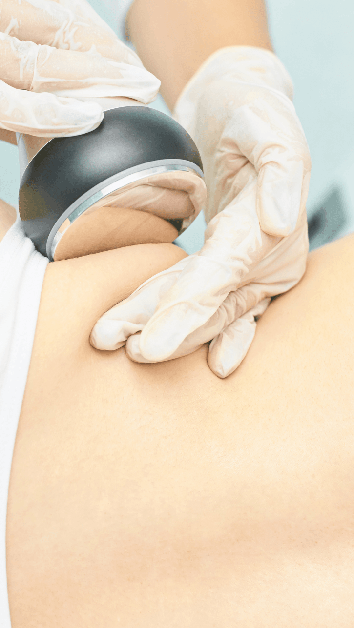 SculptSkin™ Mini 2.0 - SculptSkin ultrasonic cavitaiton body sculpting body contouring skin tightening fat reduction treatment cellulite reduction stretchmark Sculpt your body with Ultrasonic Cavitation—non-surgical fat reduction that targets stubborn areas like the waist, thighs, hips, and arms for a slimmer look.